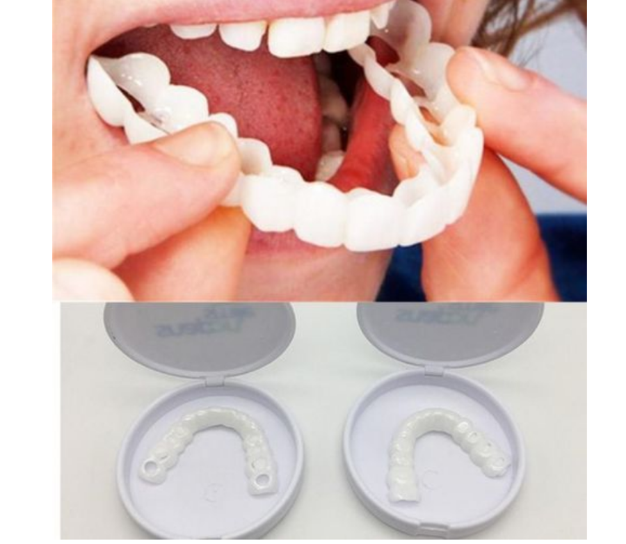 好的一种选择,它是在缺牙部位的牙床上植入一个人工金属牙根—纯钛